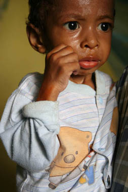 A young boy with malaria